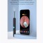 Умная ушная палочка Bebird R1 Smart Visual Spoon Ear Stick белая